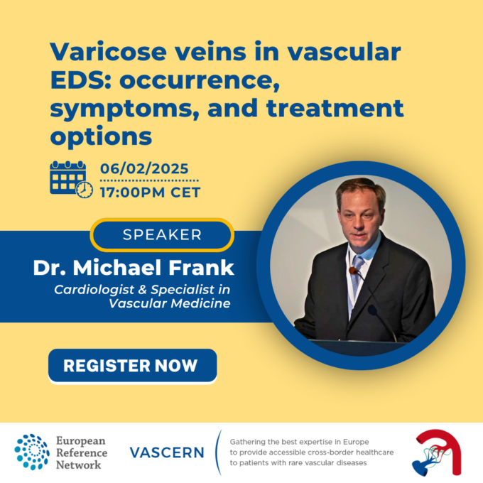 Webinar: Varicose Veins in Vascular EDS