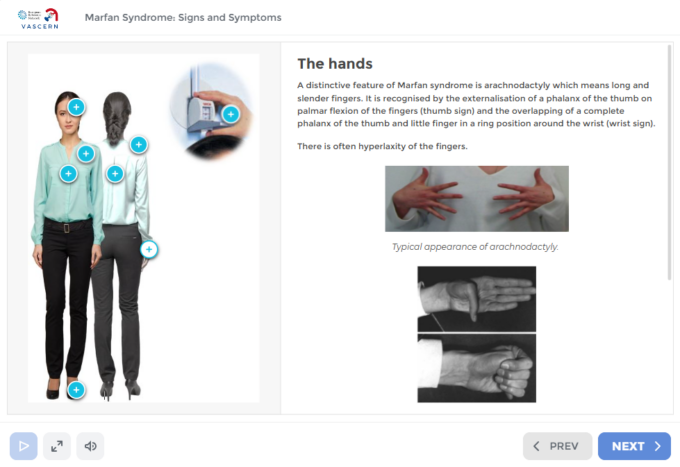 Marfan Syndrome E-Learning Course